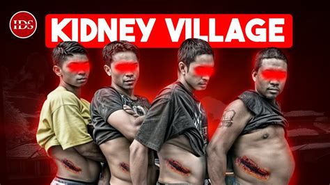Nepal's Hidden Kidney Village .